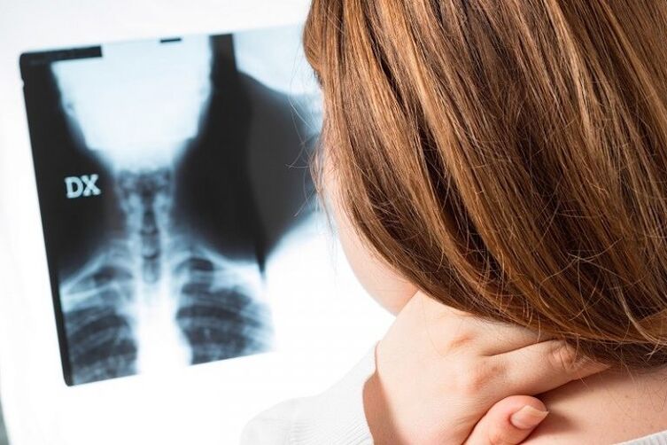 Servikal bölgenin x -ray